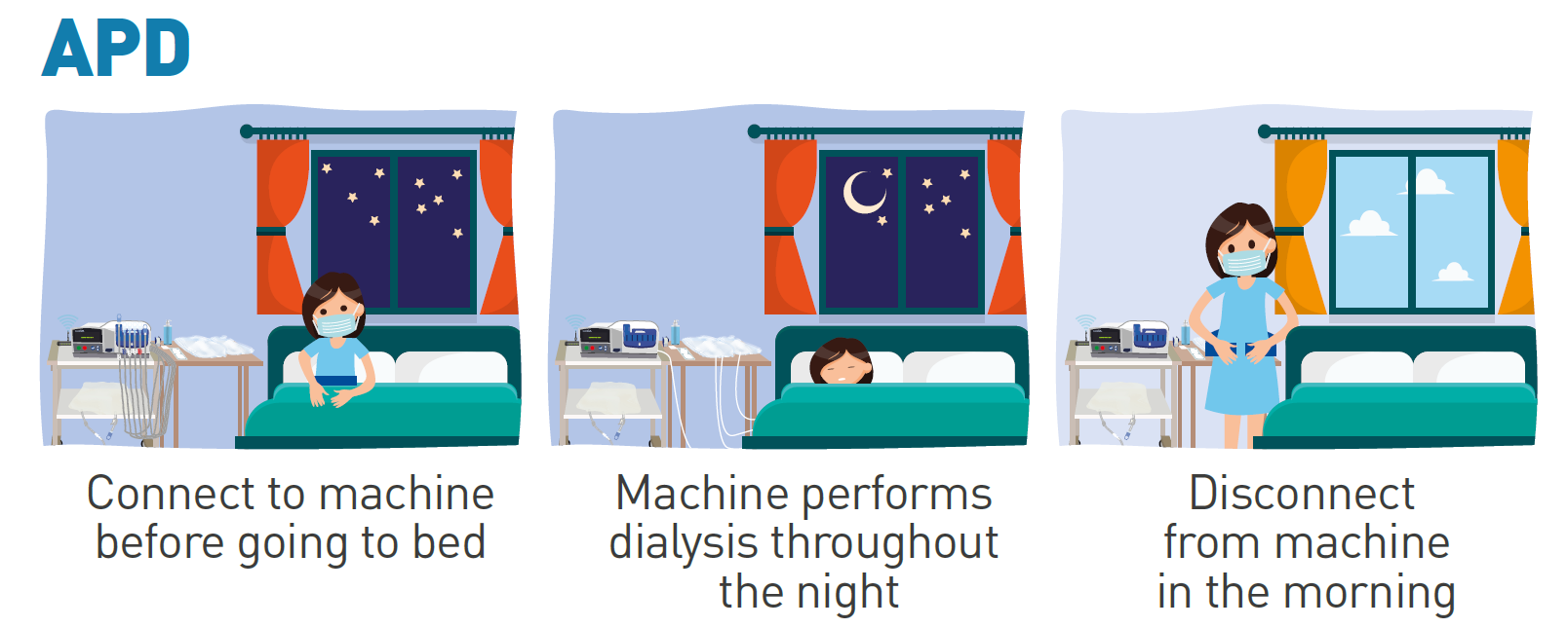 How APD Works