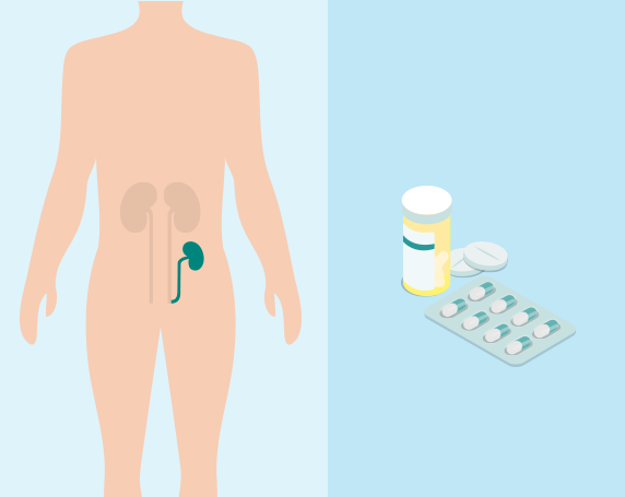 Illustration of Kidney Transplant and medication