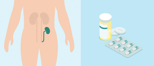 Illustration of Kidney Transplant and medication