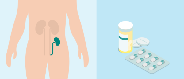 Illustration of Kidney Transplant and medication